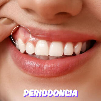 ENCÍAS