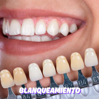 BLANQUEAMIENTO